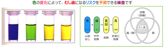 色の変化によって、むし歯になるリスクを予測できる検査です